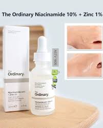 Niacinamide 10% + Zinc 1%